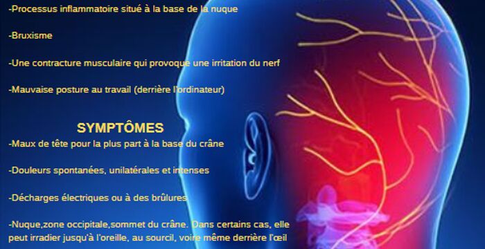 La névralgie d'Arnold : causes, symptômes et traitement ostéopathique