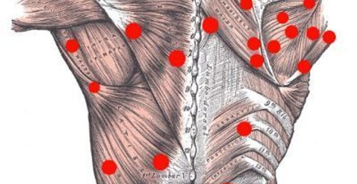 Trigger Point : ces points douloureux traités en ostéopathie
